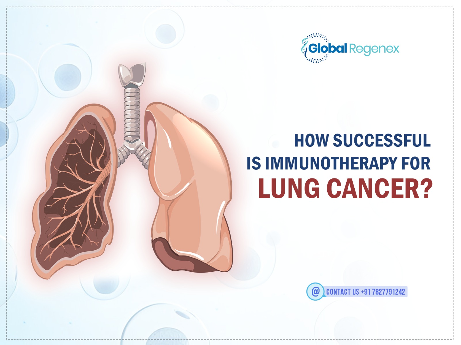 How Successful Is Immunotherapy For Lung Cancer?