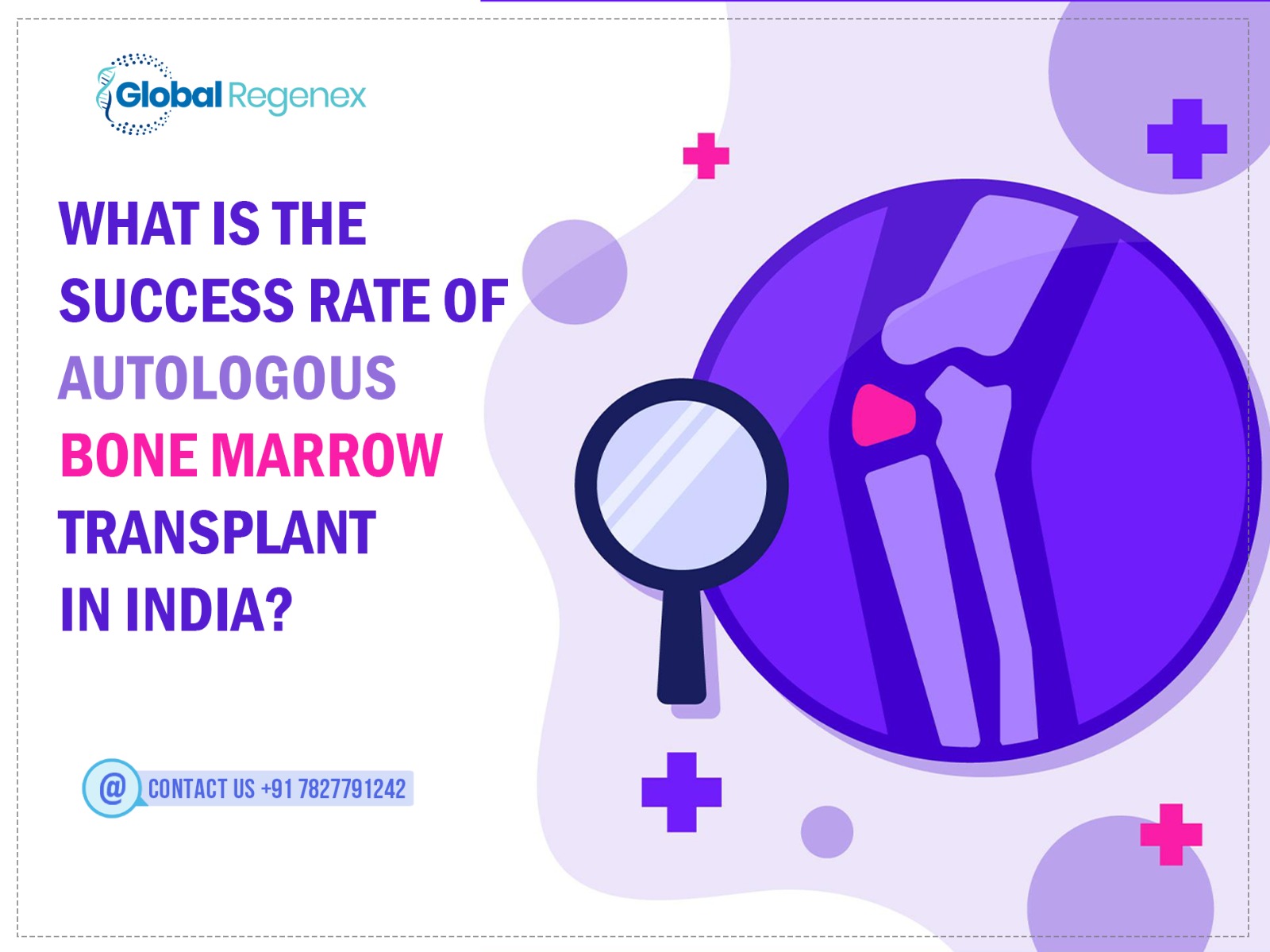 What Is The Success Rate Of Autologous Bone Marrow Transplant In India?