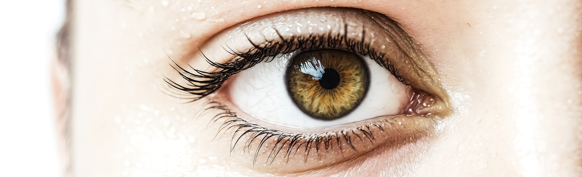 Glaucoma Disease