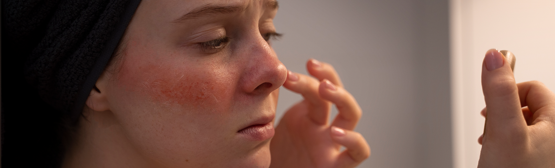 Major Skin Abrasion