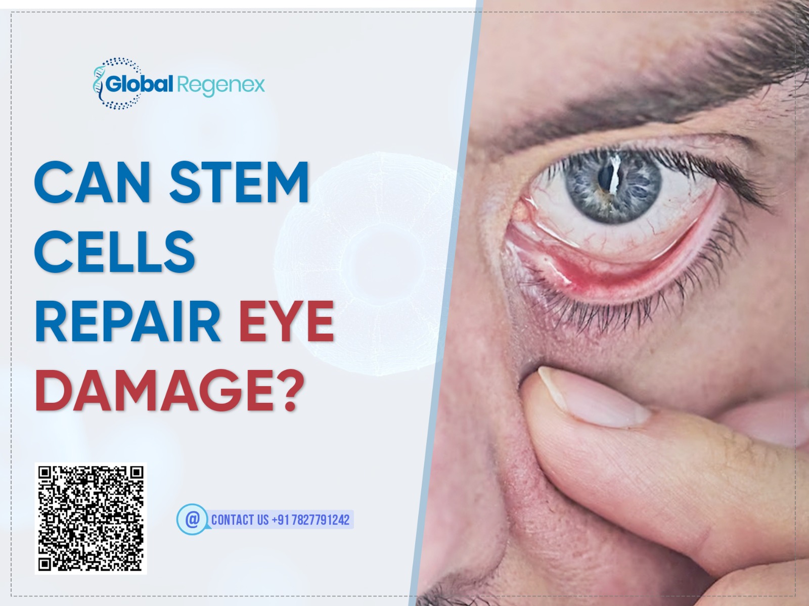 Can Stem Cells Repair Eye Damage?