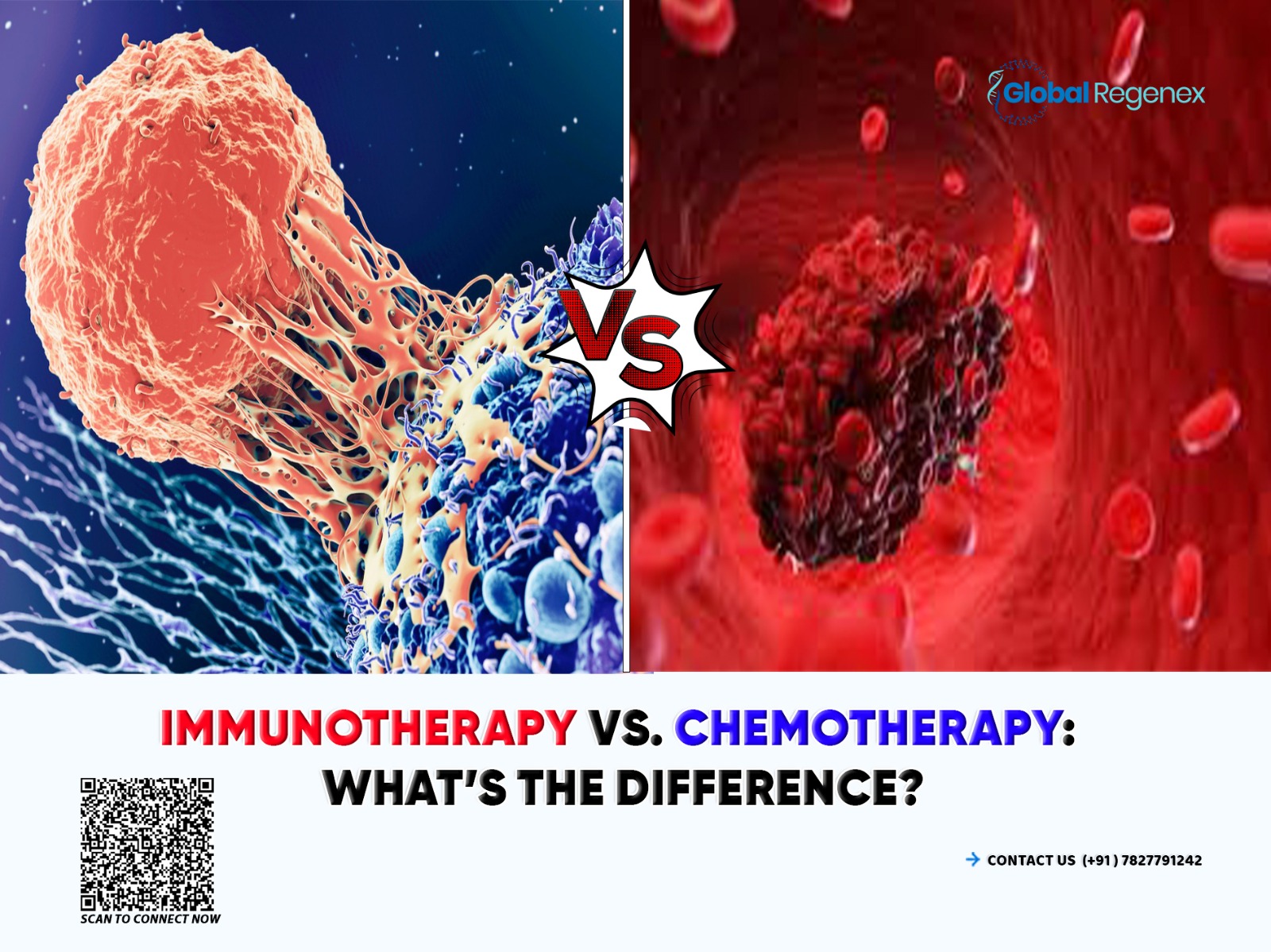Immunotherapy vs. Chemotherapy: What’s the Difference?