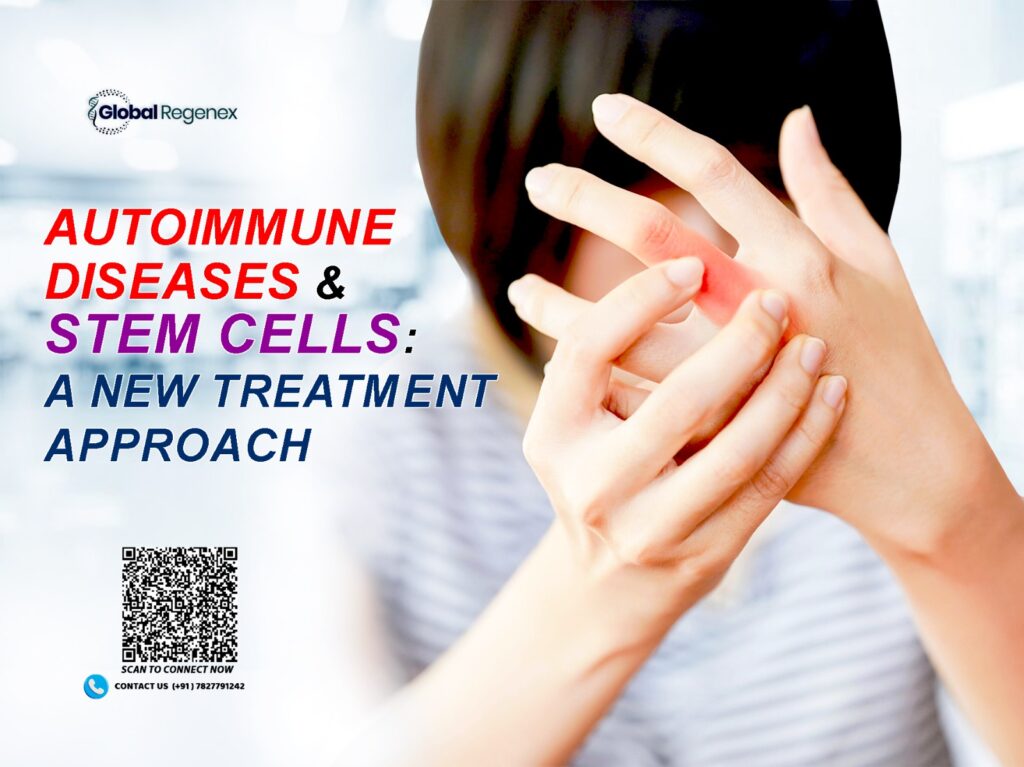 Autoimmune Diseases & Stem Cells