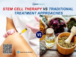 Stem Cell Therapy